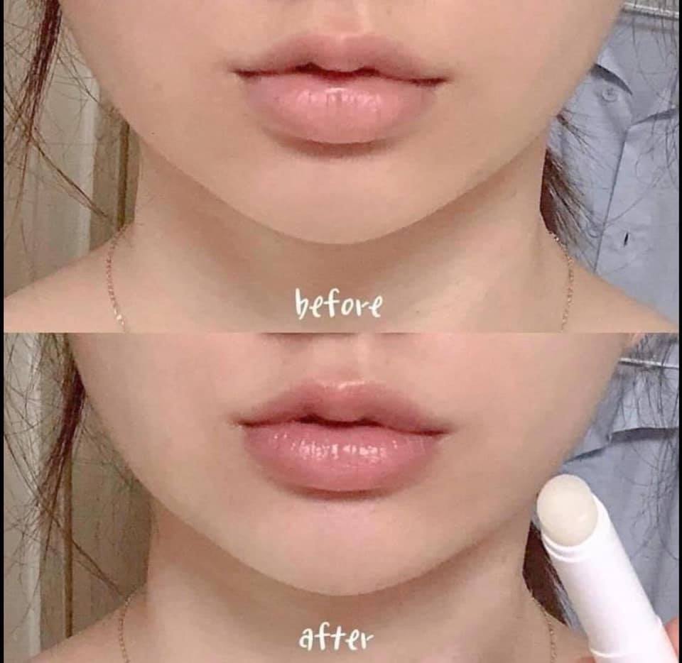 Son Dưỡng Môi Bioderma Pháp