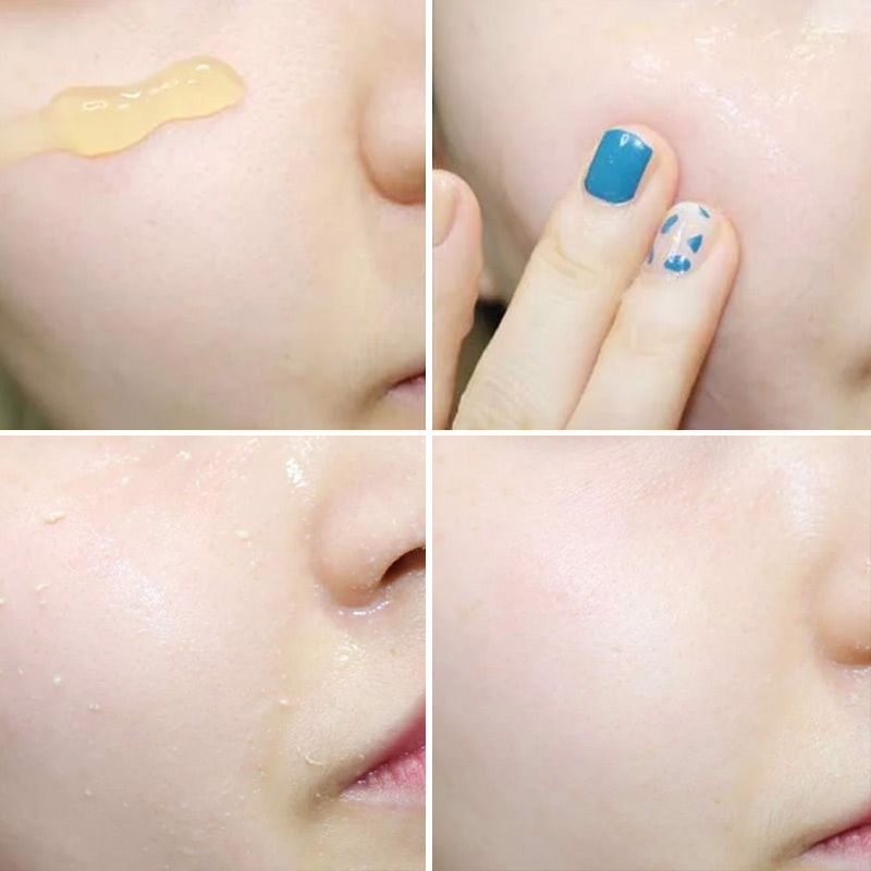 Tẩy tế bào chết Sur.Medic deep clear bright calming peeling gel
