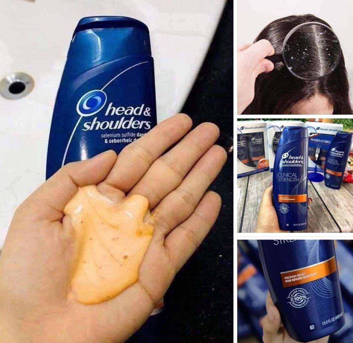 Dầu gội Head & Shoulders của Mỹ 400ml