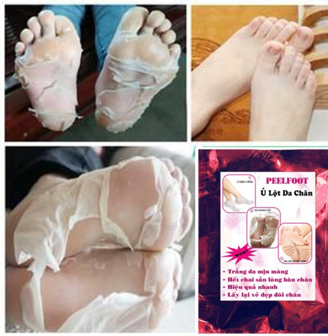 Ủ Lột Da Chân Trắng Mịn Hết Chai Sần nhám