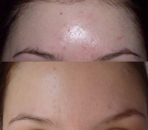 [HCM]1 Hộp tinh chất Peptide Đồng - phục hồi da