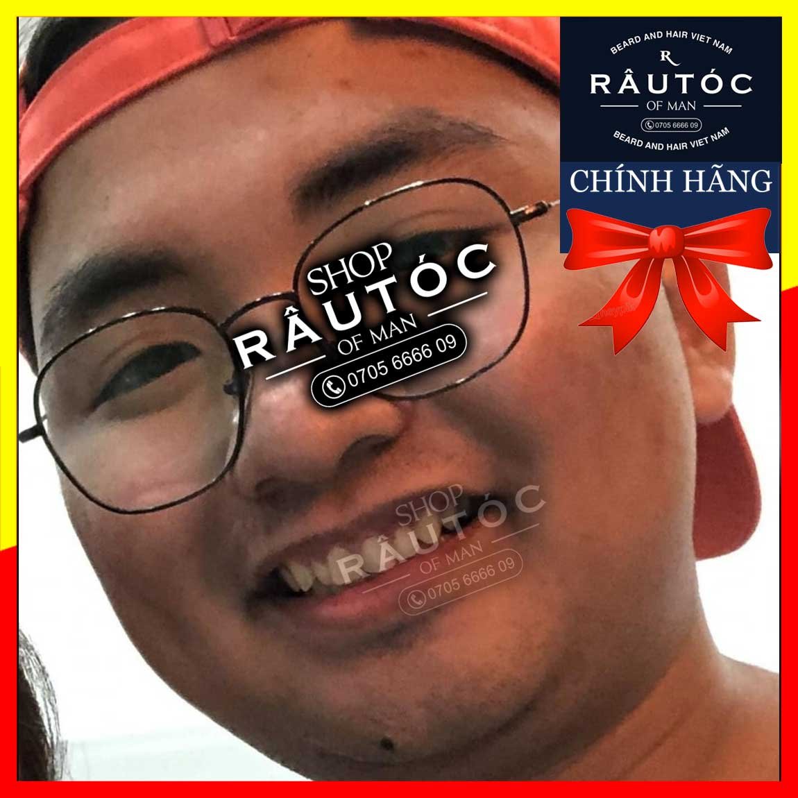 [HCM]Minoxidil 5% Rogaine