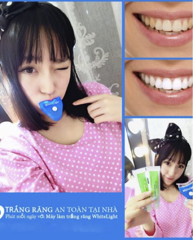 (Xả Kho) Set Tẩy Trắng Răng Tại Nhà White Light