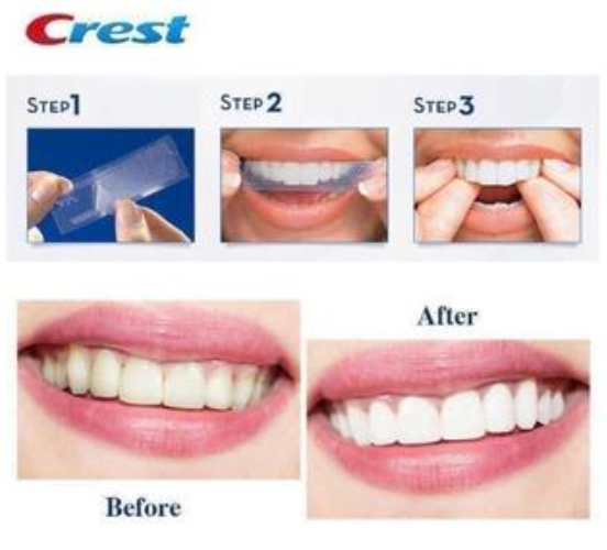 Miếng dán trắng răng Crest 3D Whitestrips Professional Effects & Supreme Bright Boost