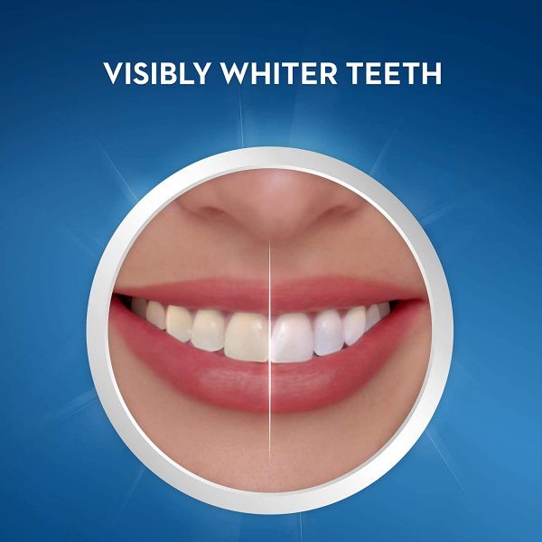 Miếng dán trắng răng Crest 3D White Supreme Professional - Dán trắng răng cho răng khoẻ mạnh