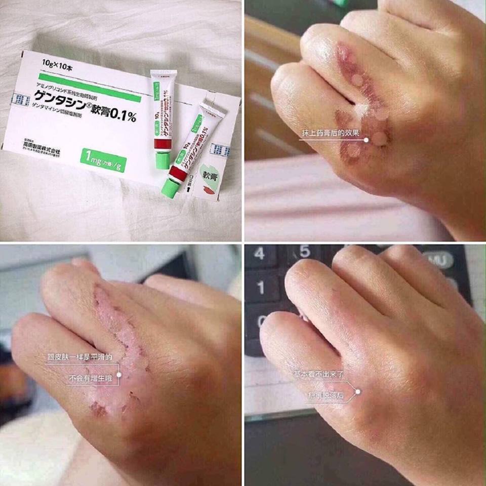 [HCM]Gel Làm Mờ Sẹo MSD Gentacin Ointment 0.1- Gentamicin Sulfate - 10g