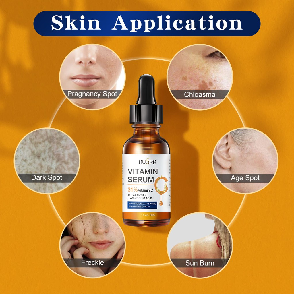 Serum Vitamin C 31% NUSPA giúp giảm quầng thâm, tàn nhang cho làn da sáng và căng mọng