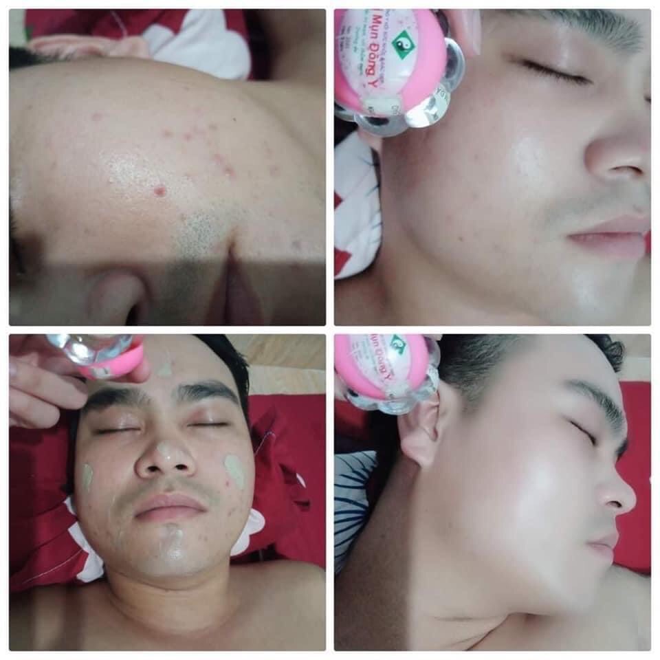 Kem mụn Đông Y Hoa Đào lọ lớn (Tặng mặt nạ dưỡng da)