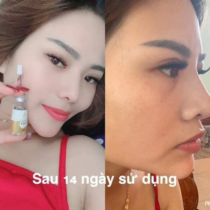 Serum trắng da TRẺ HÓA 7 DAY OLIC