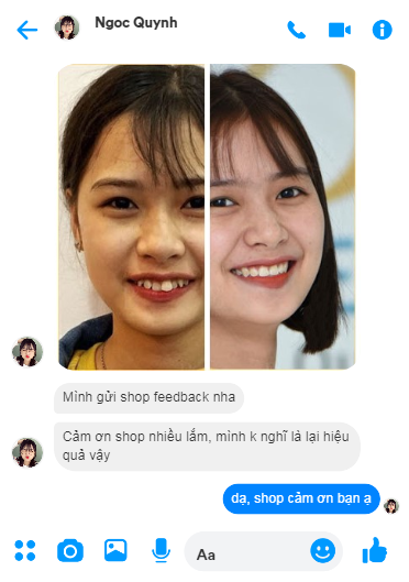[HCM]DỤNG CỤ NIỀNG RĂNG | Dùng cho người lớn ( A1 + A2 +A3)