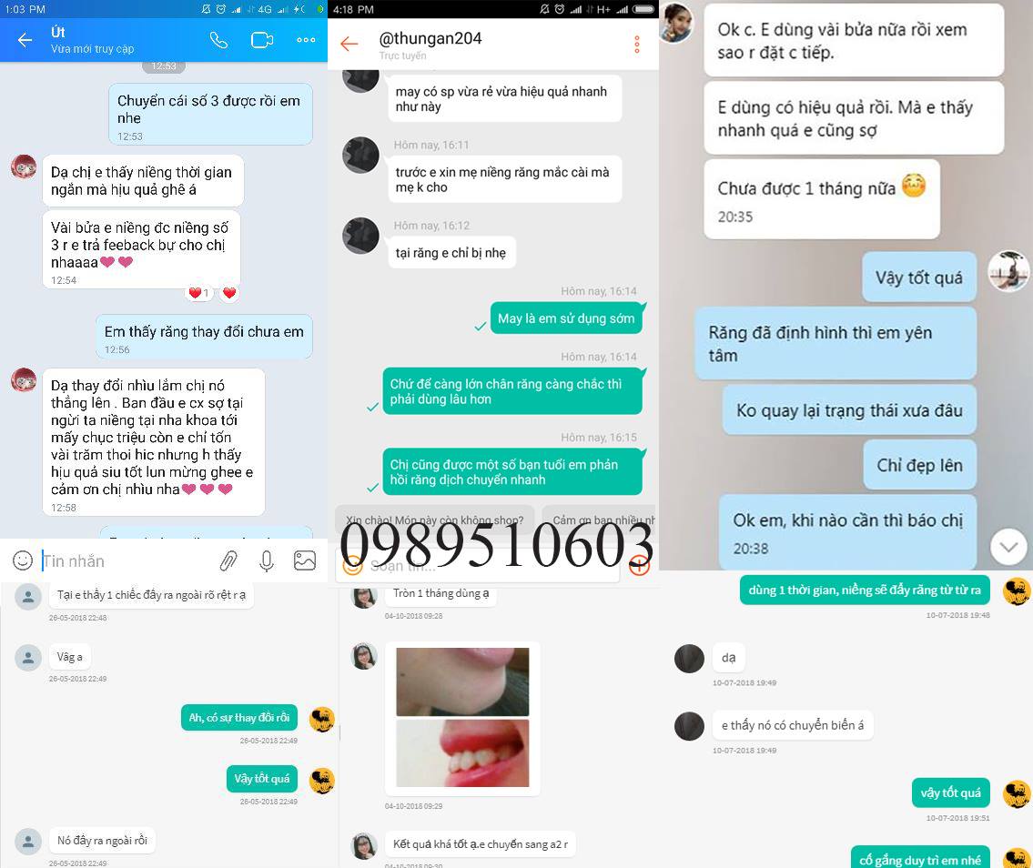 [HCM]DỤNG CỤ NIỀNG RĂNG │Lẻ hàm A3