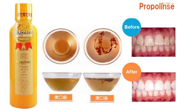 Nước Súc Miệng Nhật Bản
