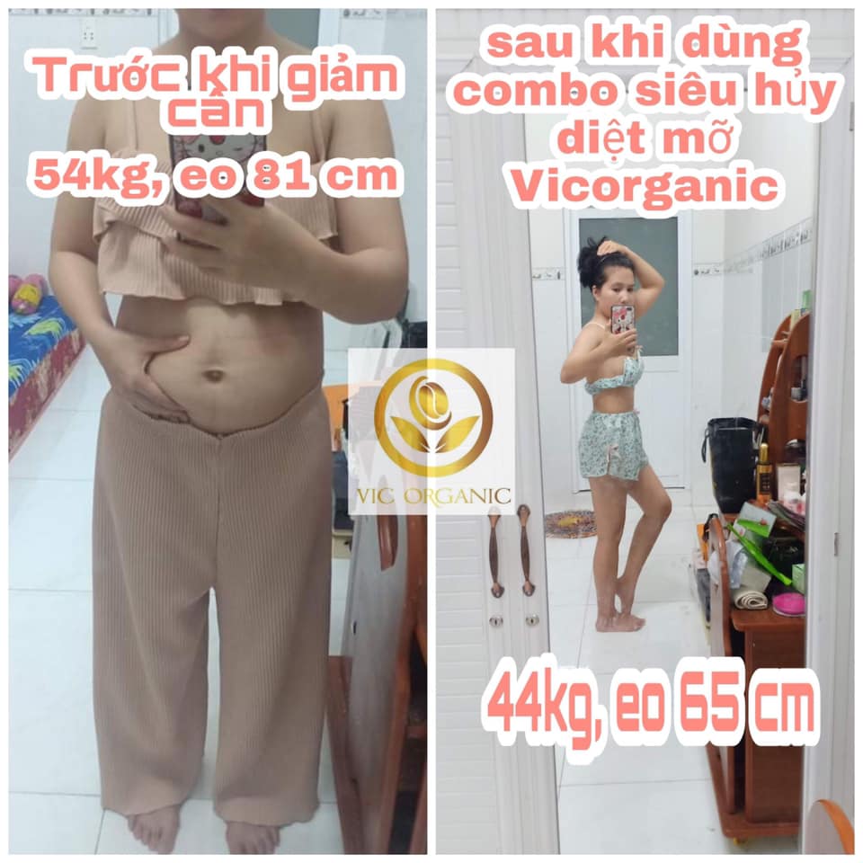 [Chính Hãng] Combo 5 ống siết eo vitC giá sỉ eo thon giảm bụng
