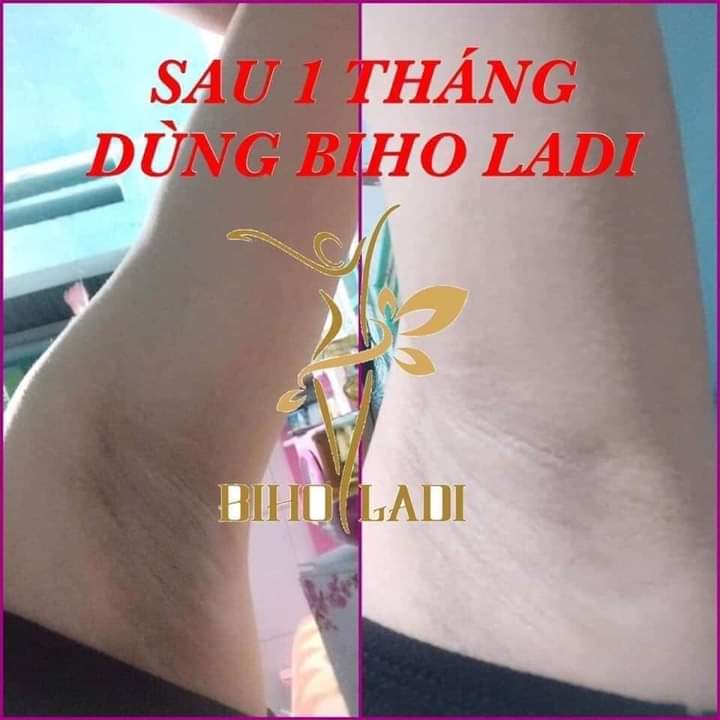 siêu dưỡng thâm vùng nách bụng bikini biholadi5s