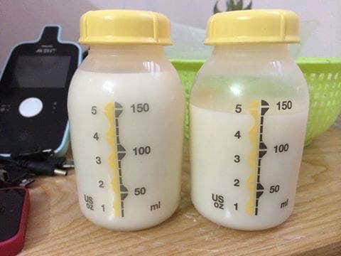 Bình trữ sữa Medela 150ml nắp dầy