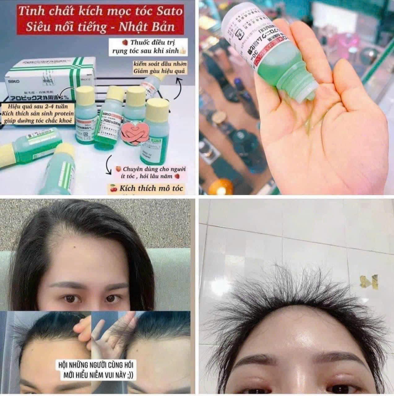 Tinh chất Sato Chấm Hói Mọc Tóc Giảm Rụng Tóc 30ml Nhật Bản - 1 Lọ