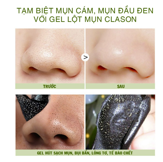 Gel lột mụn than tre hoạt tính 50gr