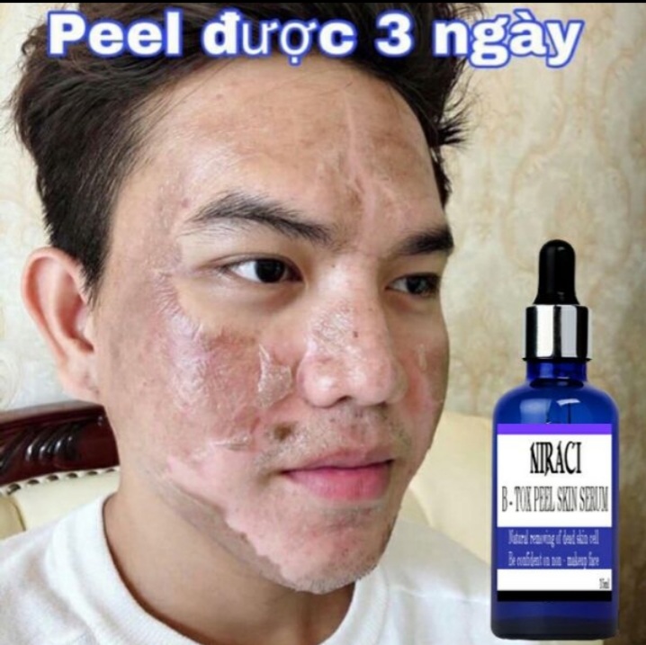 [HCM]Feel .Thay da .Xóa Nám .Trắng Da  Niraci Hàn Quốc