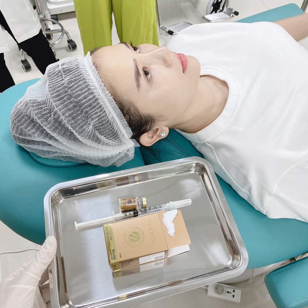 BOTOX INNOTOX 50 TIÊM CĂNG TRÁN CỰC ĐẸP ??