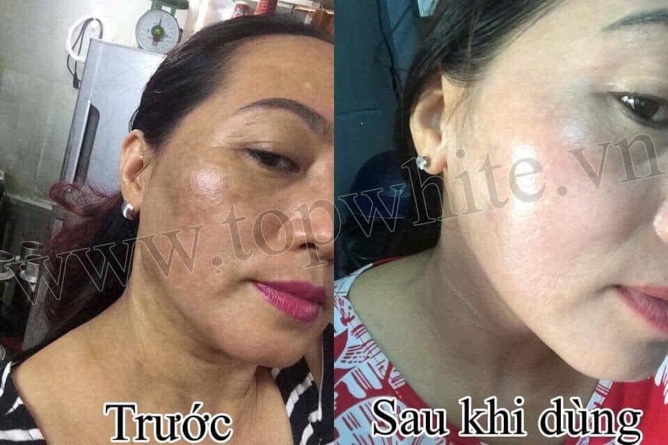 Kem Dưỡng Trắng Da Ban Đêm Topwhite