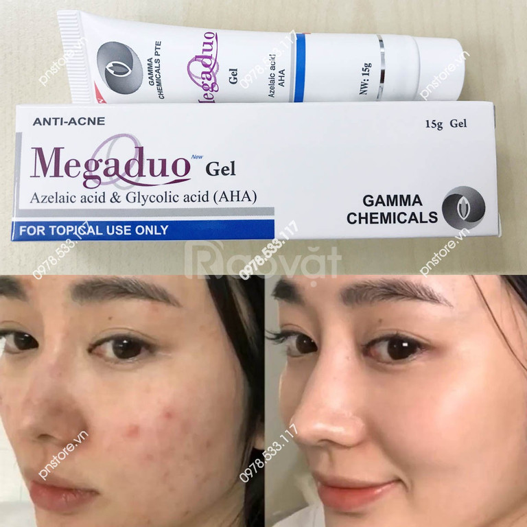 Megaduo - Gel giảm mụn trứng cá - 15g