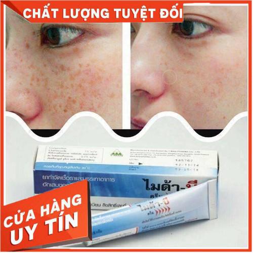 Kem khử nám myda -b thái lan tuýp 15gram chuyên khử nám chuyên sâu , tàn nhang hiệu quả