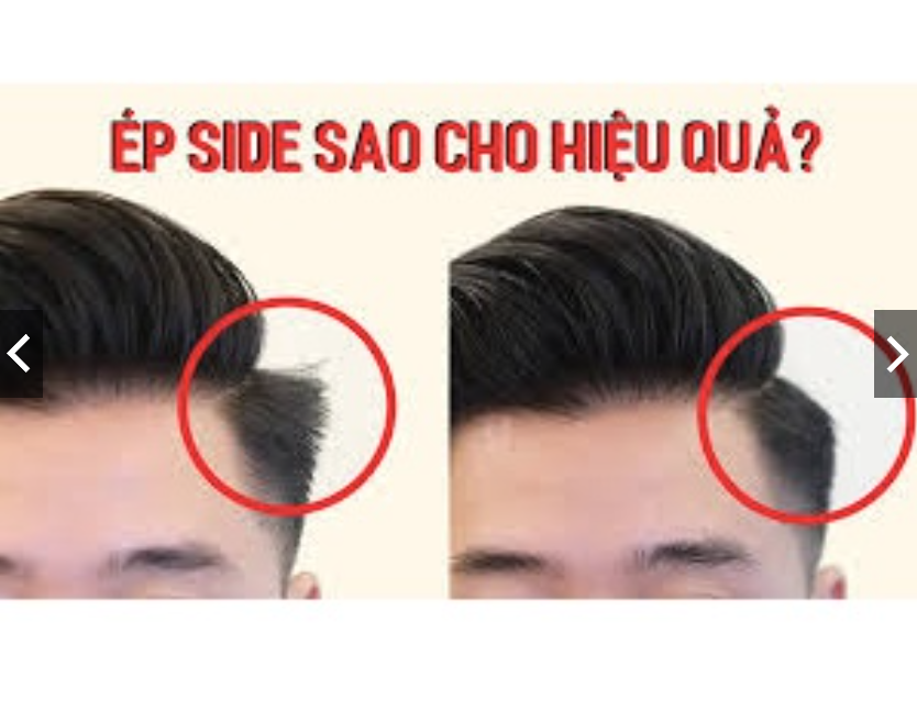 Ép side tóc nam 3 in 1 Hoa Anh Đào
