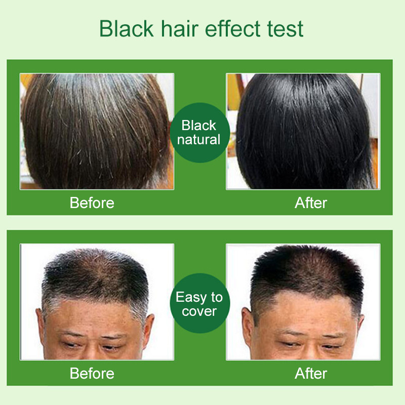 (NK Anh quốc ) Dầu gội đen tóc Dexe - 100% thảo dược Hộp 10 gói