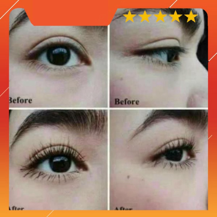 Serum Mọc Mi, Mày, Râu, Tóc Thái Lan (Bill Thái)