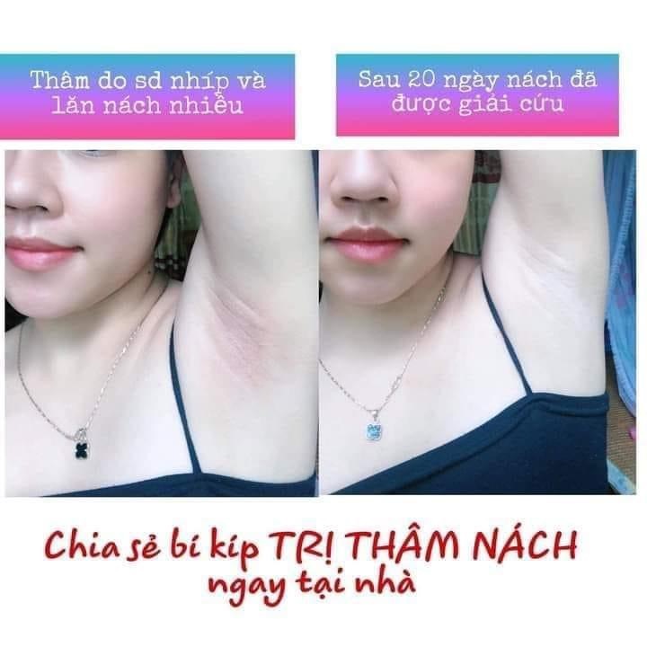 Kem Siêu Dưỡng Thâm 5S Biho Ladi