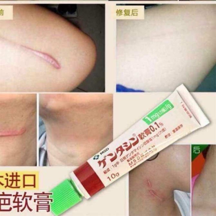 Kem liền sẹo Gentacin Nhật Bản 10g