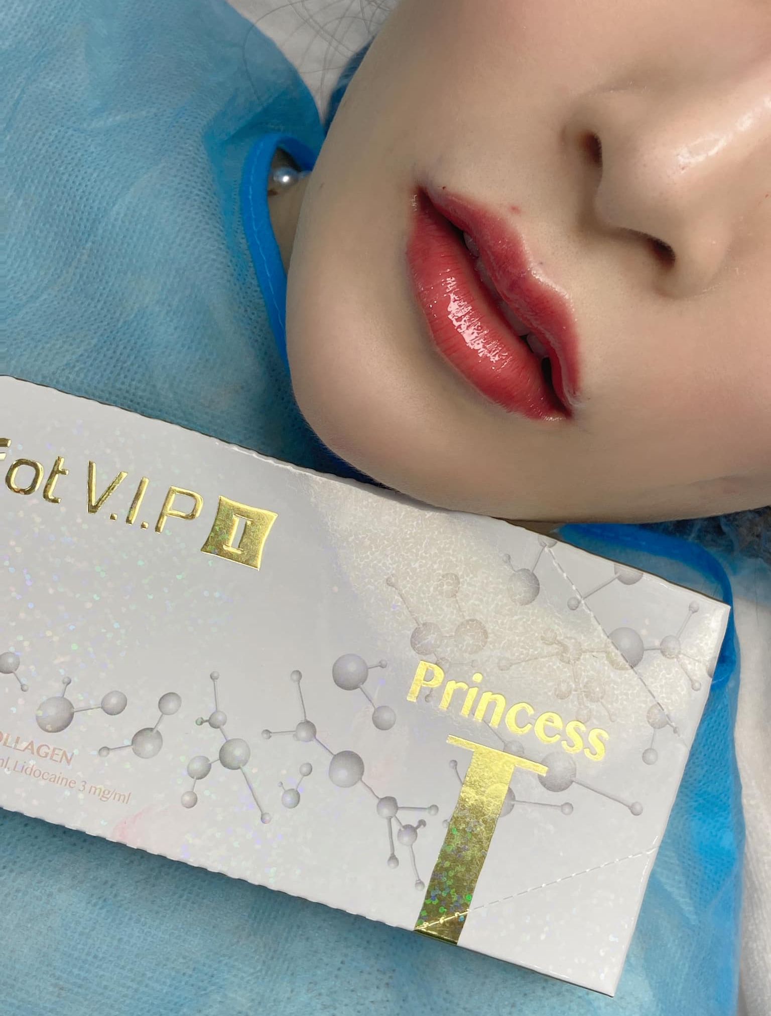 Filler Jariot vip