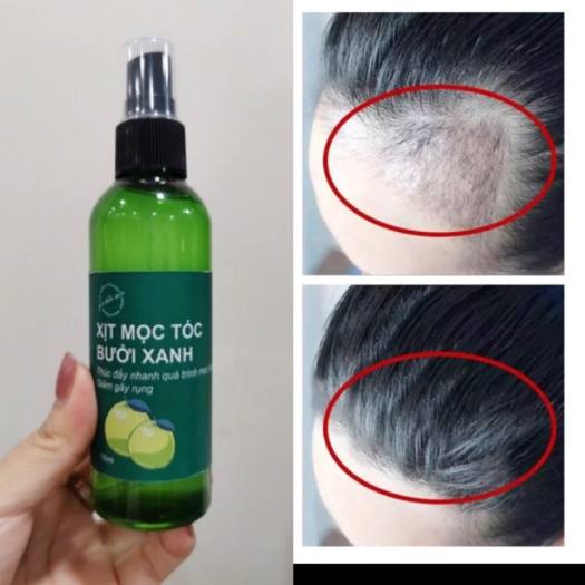 Tinh dầu bưởi xanh kích mọc tóc siêu dày và đẹp 100ml
