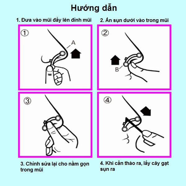 [HCM]Sụn nâng mũi 3D Hàn Quốc