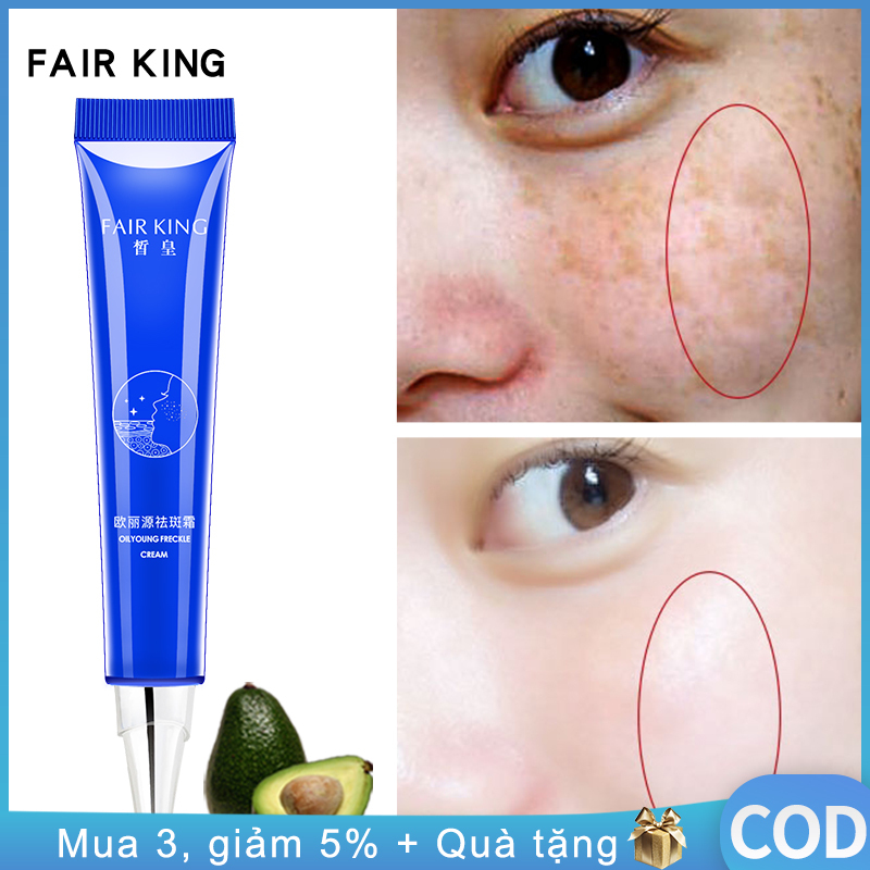 FAIR KING Kem làm mờ vết thâm làm trắng da Serum xóa vết thâm làm sáng da giảm đốm tàn nhang Kem dưỡng da mặt 20g - intl giá rẻ