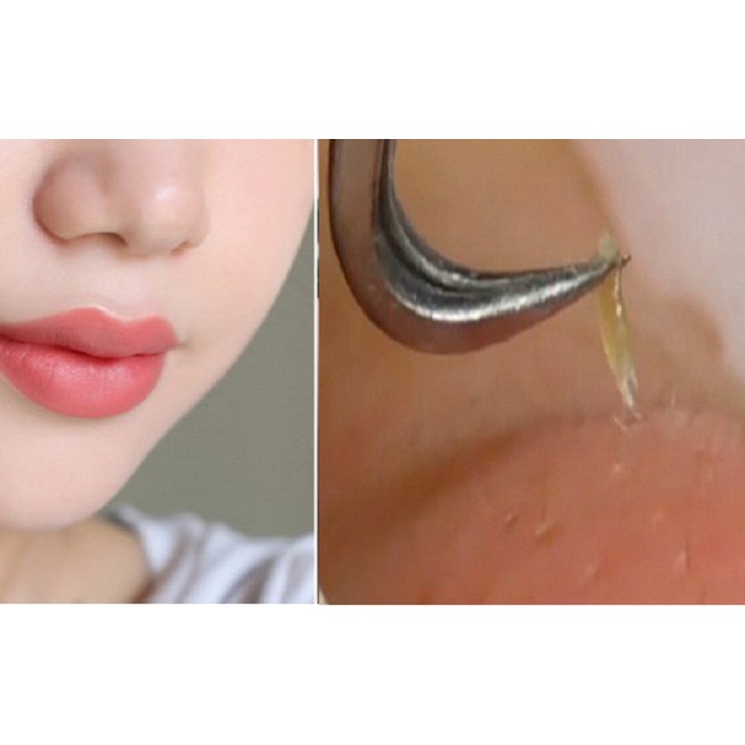 Nhíp Gắp Mụn Không gỉ Hàng Việt Nam