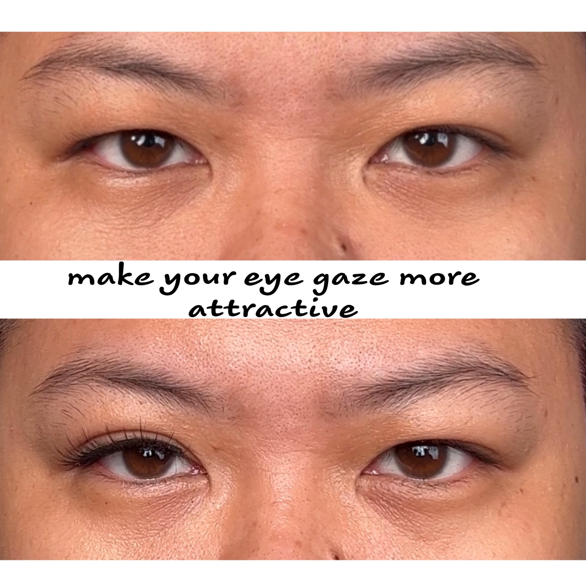 Invisible Eyelid tape ( miếng dán kích mí tàng hình)