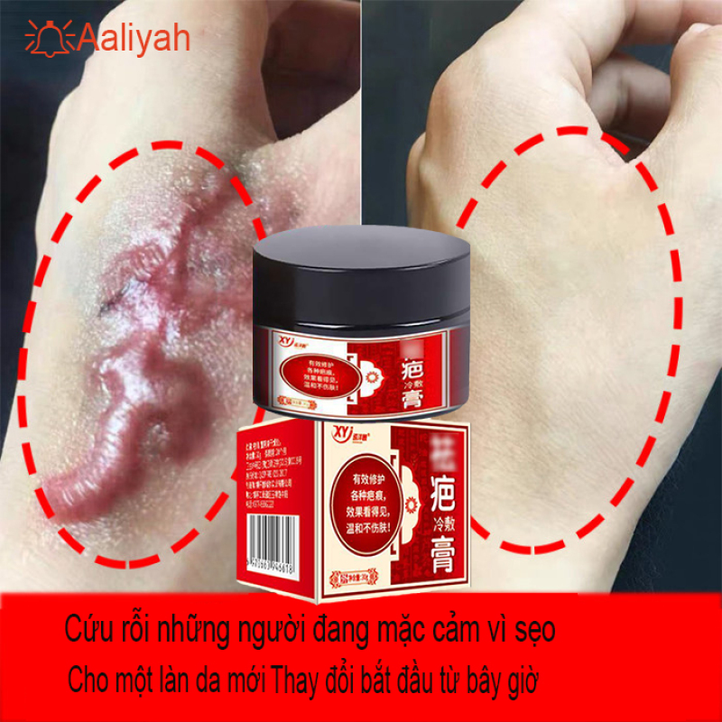 Kem chuyên xóa sẹo do ngã, sẹo bỏng, sẹo mụn, phục hồi da bịtrầy xước, mờ sẹo thâm mụn,mờ thâm ,khôi phục da 30g giá rẻ