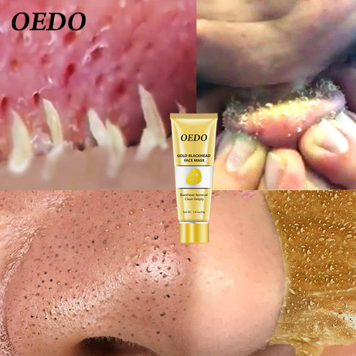 OEDO Mặt nạ vàng trị mụn đầu đen loại bỏ mụn kiểm soát dầu thu nhỏ lỗ chân lông kem làm sạch sâu lỗ chân lông bụi bẩn chăm sóc da mặt 40g- INTL