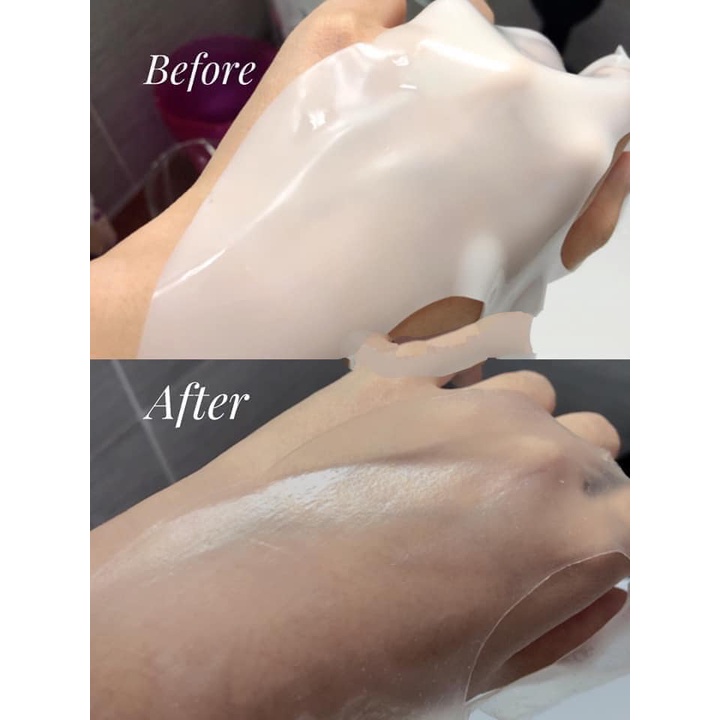MẶT NẠ DƯỠNG DA THẢI ĐỘC DERM ALL MATRIX MẪU MỚI
