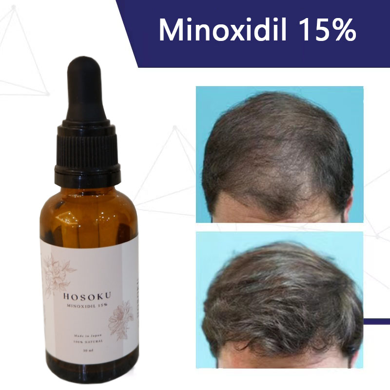 Dầu thầu dầu mọc tóc Minoxidil hosoku 15