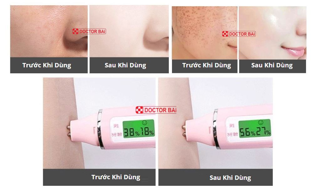 Kem Mờ Nám Trắng Da Doctor Bai Green Tea