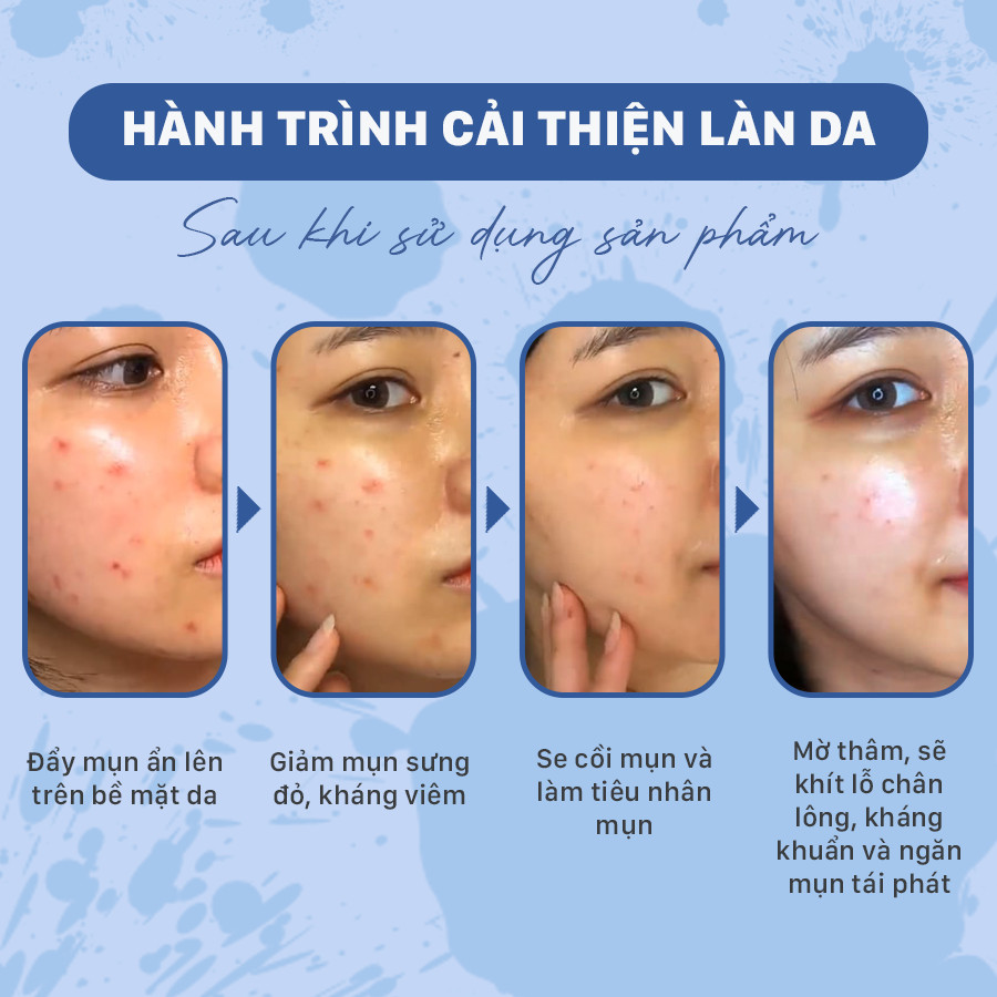 Sữa rửa mặt giảm mụn dạng bọt OMUSE Blemish Solution Clarifying Foam Cleanser 150ml