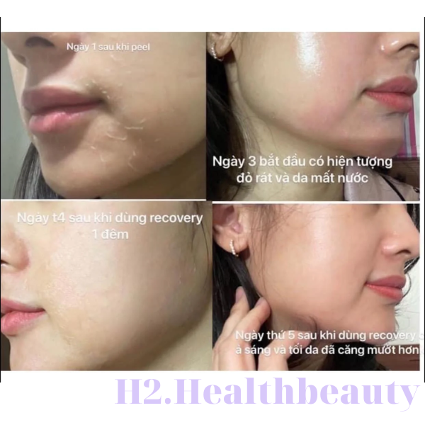 Kem phục hồi da RECOVERY CRÉME