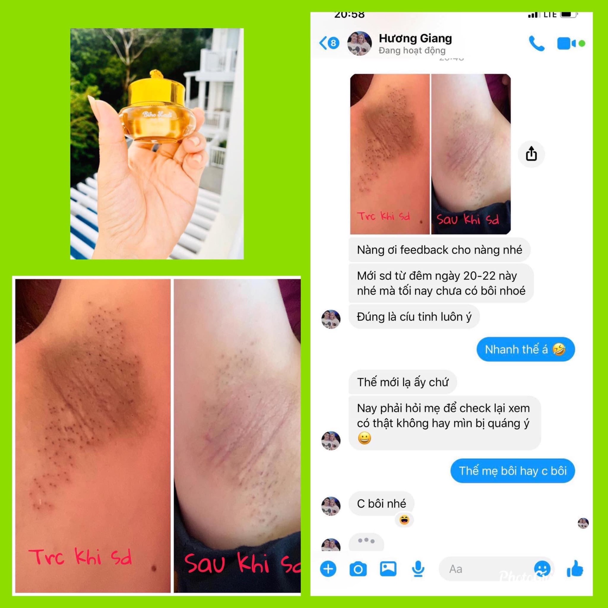 Siêu Dưỡng Thâm 5s Biho Ladi