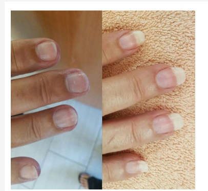 Dưỡng móng nail cao cấp CND - Cứng móng. chống nấm 3.7ml