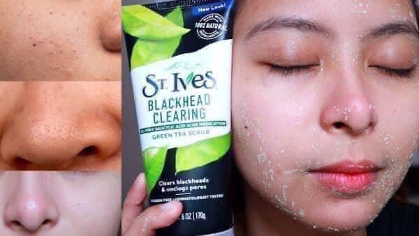 Sữa Rửa Mặt Tẩy Da Chết St.Ives