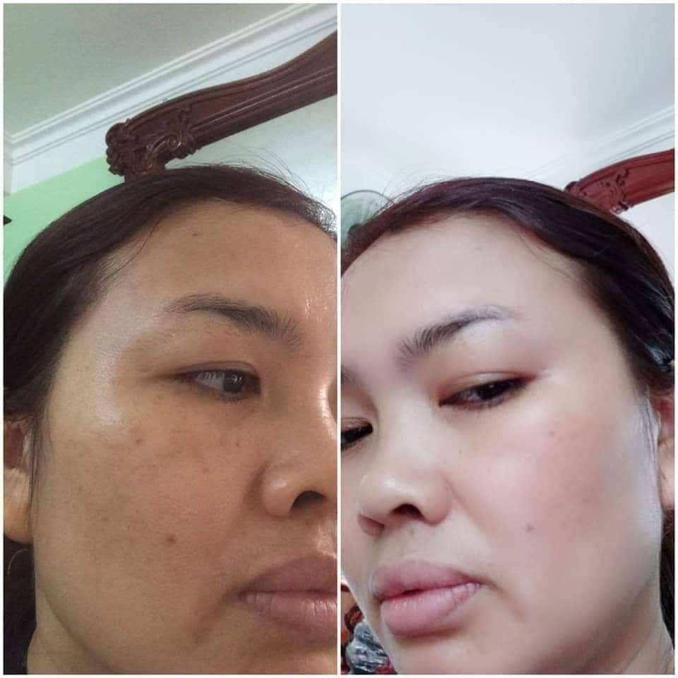 Kem face king Thái Lan 5in1 A Đạt