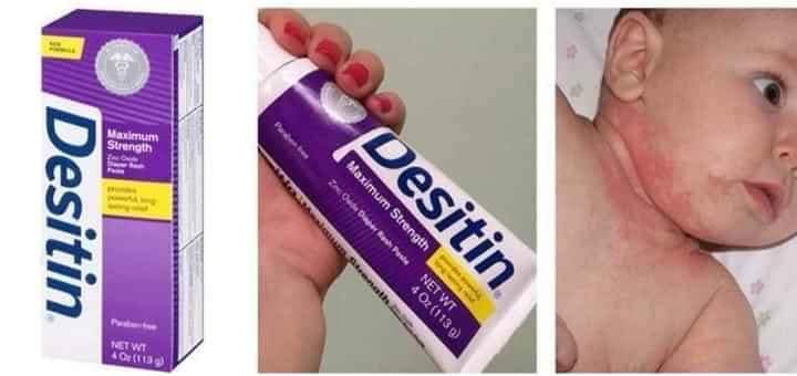 Kem chống và trihăm Desitin tím Mỹ