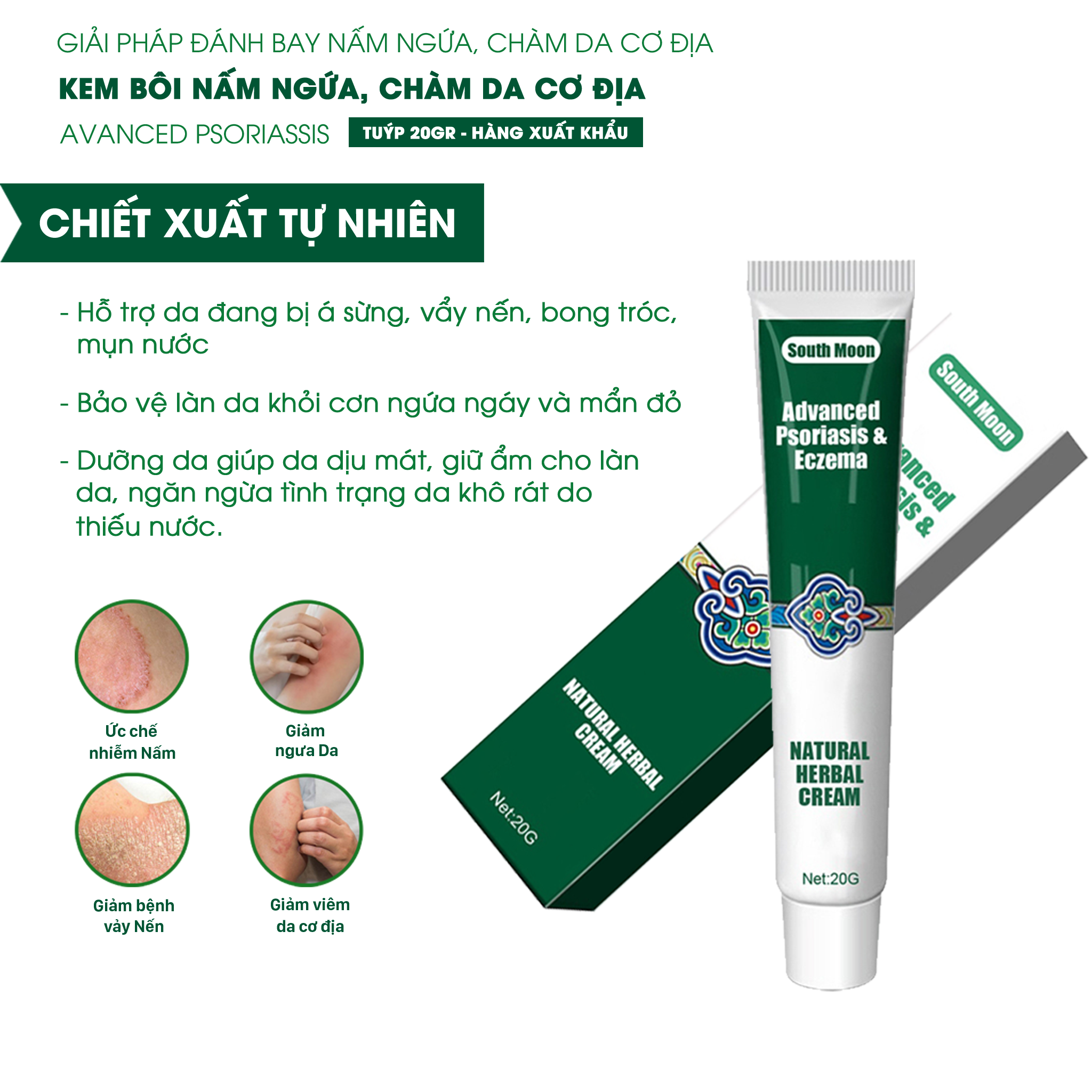 Kem bôi nấm ngứa, vảy nến, chàm viêm da cơ địa